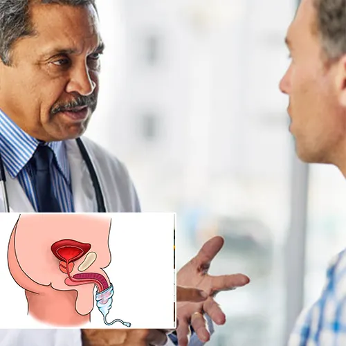 During Your Penile Implant Surgery: Comfort and Care at   Urology Centers of Alabama 
